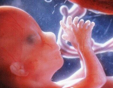 人型支原体感染会对胎儿的危害