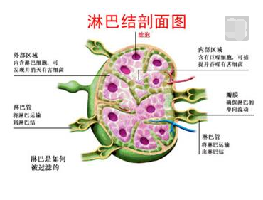 淋巴瘤早期症状