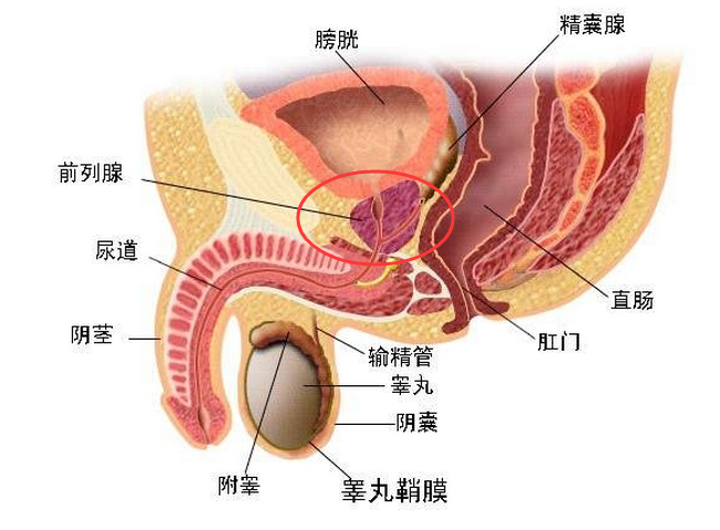 衣原体前列腺炎感染的治疗