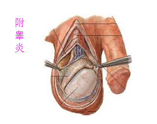 附睾隐痛压力大,附睾炎