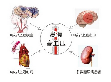 高血压