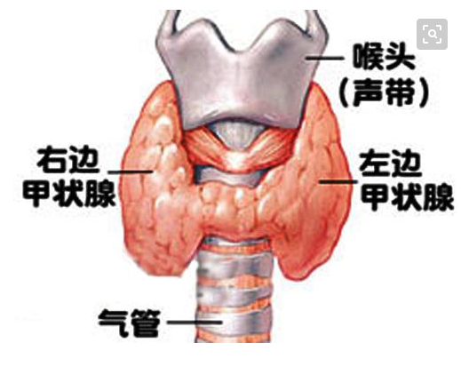 甲亢好发人群