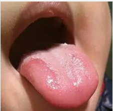 孩子咳嗽老不好怎么办