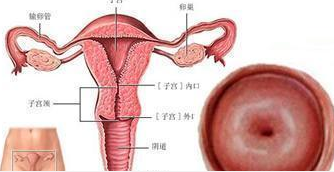 子宫内膜炎病因