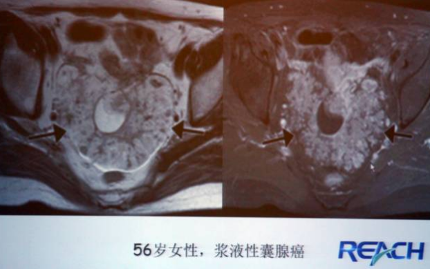 图片11