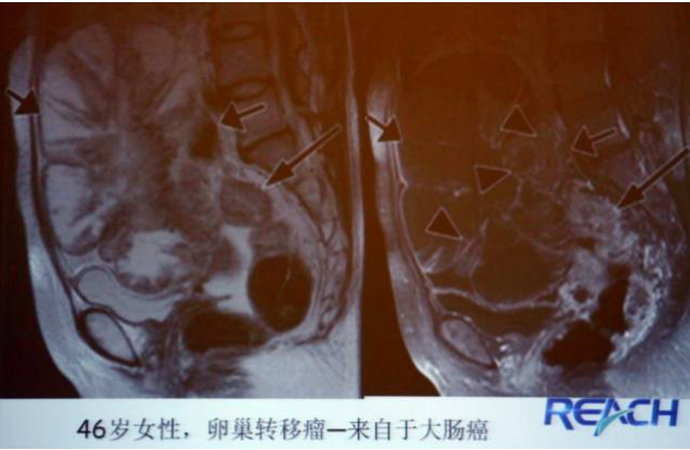 图片14