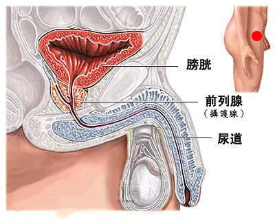 前列腺炎为何会导致尿频