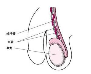 输精管堵塞的病因和治疗