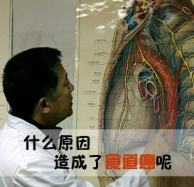 食管肿瘤