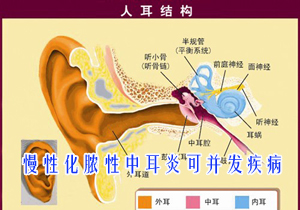 化脓性中耳炎面瘫并发症
