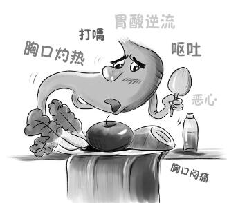 胃食管反流胸痛