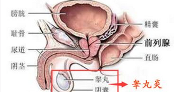 睾丸疼痛是怎么回事