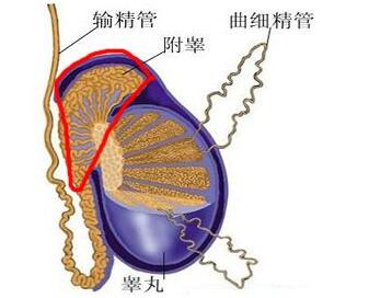 附睾囊肿的危害