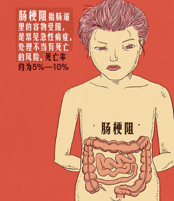 肠梗阻是怎么引起的