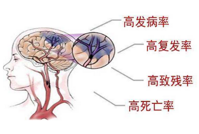 七种食物预防脑中风