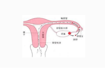 输卵管堵塞原因