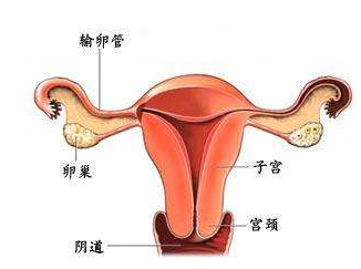 输卵管炎引发宫外孕