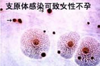 支原体是怎么感染上的