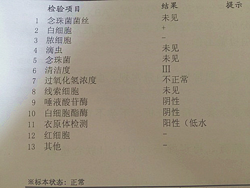 衣原体要做什么检查,衣原体检查要多少钱