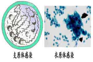 支原体衣原体能自愈吗