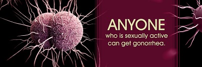 gonorrhea-2.jpg