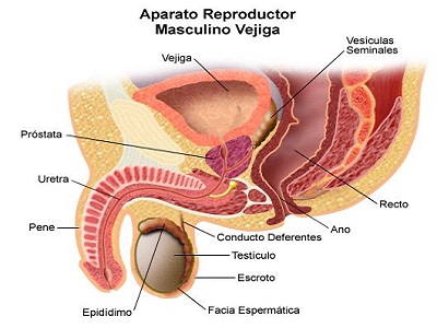 Seminal-Vesiculitis.JPG