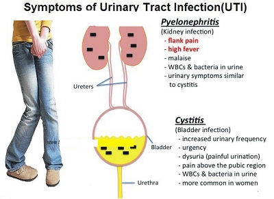 symptoms-of-uti.jpg
