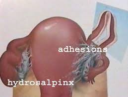 download.jpg
