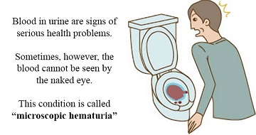 blood in urine