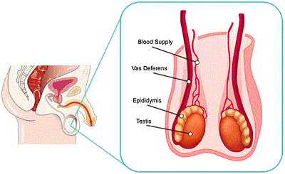 testicular pain