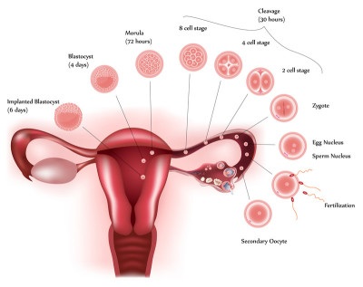 endometriosis