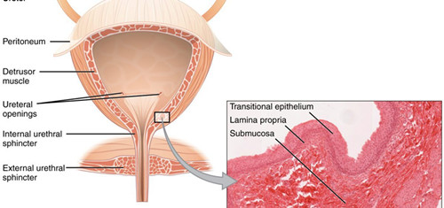 interstitial cystitis 11_副本.jpg