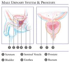 chronic nonbacterial prostatitis.jpg