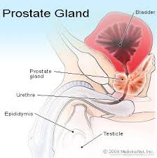 chronic prostatitis.jpg