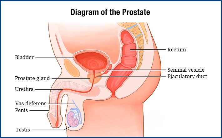 chronic bacterial prostaititis treatment.jpg