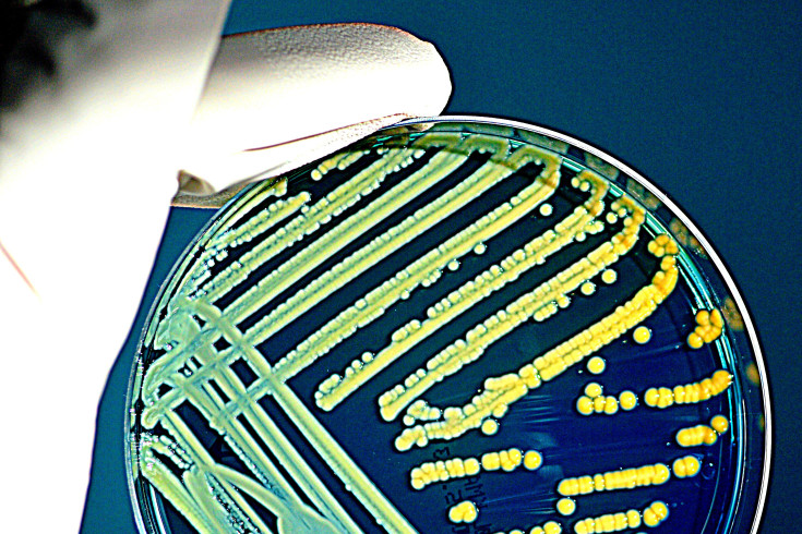 antibiotics vs herbal medicine.jpg