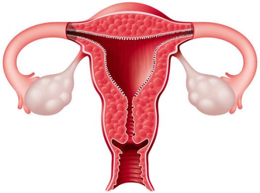 endometrial thickening.jpeg