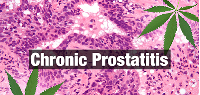 Symptoms of Chronic Prostatitis Should Be Treated Differently