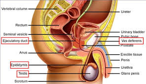 Infertility in Men Can be Led by Three Factors