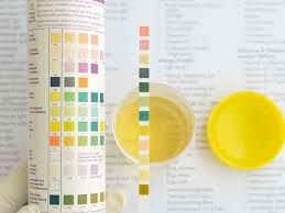 Bright Yellow Urine May Suggest Genitourinary Infection