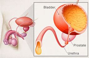 How to Treat Drips After Urinating?